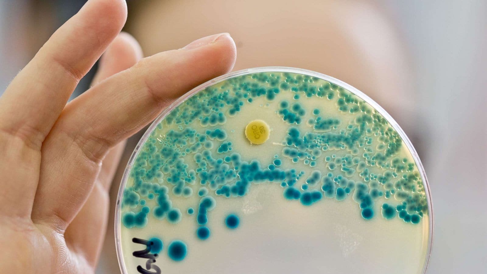 The alarming rise of nightmare bacteria: 70% increase in infections